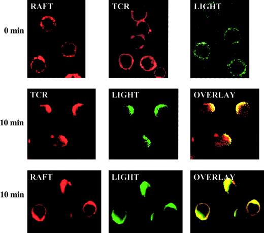 Fig. 7. LIGHT rapidly translocates into caps of TCR and rafts on the surface of activated T cells. / BALB/c spleen T cells were cross-linked with anti-CD3 and anti-CD28 for 0 or 10 minutes. The locations of TCR (stained with biotin–anti-CD3 followed by Alexa 594–streptavidin in red), rafts (stained with Alexa-cholera toxin in red) and LIGHT (stained with TR6-Fc followed by Alexa 488–anti–human IgG in green) were revealed by confocal microscopy. Original magnification, ×600.