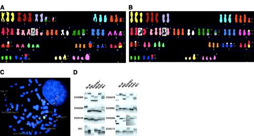 Fig. 1. Cytogenetic and molecular characterization of the SAM-1 and K-562 cell lines. / SKY analysis of SAM-1 (A) and K-562 (B) cells. Translocations are identified with numbers, and structural abnormalities (observed by G-banding) are indicated with arrows. See text for complete description. (C) Using SAM-1 cells, dual-color FISH probe forBCR, (green signal), was seen on 22q11 on 2 normal chromosomes 22, ABL, (red signal), was seen on the 9q34 band on the del(9)(p13) and on both ends of der(9)t(9;9)(p1?3;q22). Simple fusion signals were observed in Ph chromosome and in add(2). Multiple fusion signals were seen in the der(13) and in the der(22). (D) PCR-based analysis of 8 dinucleotide repeat loci in 6 myeloid leukemia cell lines. The D20S889 marker is on p-arm, whereas all others are on the q-arm of chromosome 20. SAM-1 and K562 cells exhibit an identical pattern of PCR amplification.