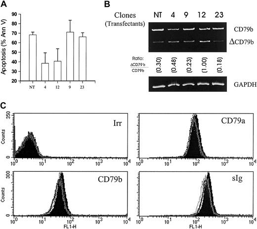 Fig. 3. Sensitivity of Ramos-EHRB clones to anti-Fcμ mAb following transfection with ΔCD79b. / (A) Untreated cells (NT) and 4 ΔCD79b-transfected clones of Ramos-EHRB were cultured (5 × 105/mL) in the presence of anti-Fcμ mAb for 24 hours before assessing apoptosis via flow cytometry using the annexin V–FITC and PI as detailed in Figure 2. Apoptosis was also verified using the hypo-PI method to detect fragmented DNA (data not shown). The histogram shows average results, ± SD, for 3 experiments on each clone. (B) The expression of CD79b and ΔCD79b in the nontransfected (NT) and transfected clones, 4, 9, 12, 23, was confirmed by RT-PCR as detailed in Figure 1. Ratios show the relative level of ΔCD79b/CD79b. GAPDH message was also determined as a control to ensure that equal amounts of DNA were present in each sample. (C) The levels of surface BCR on wild-type and ΔCD79b-transfected Ramos-EHRB clones as measured by flow cytometry. The cells were stained with FITC-conjugated mAb to CD79a (ZL7-4), CD79b (ZL9-1), sIg (M15/8), and an irrelevant control mAb (Irr, CP1/17). No difference was seen in the various clones compared with untransfected cells.