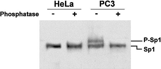 Fig. 5. Sp1 is phosphorylated in PC3 but not HeLa cells. / Nuclear extracts were treated with alkaline phosphatase for 45 minutes at 37°C prior to fractionation on an 8% SDS-polyacrylamide gel for 3 hours at 150 V. Transfer of proteins to PVDF membrane and overlay with anti-Sp1 polyclonal antibodies was as described in Figure 4. The upper band appearing in the PC3 nuclear extracts (P-Sp1), which disappears after alkaline phosphatase treatment, indicates that Sp1 is phosphorylated in this cell line.