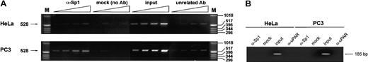 Fig. 6. Detection of the presence of Sp1 and Sp3 on the uPA GC-/GA-rich region by chromatin immunoprecipitation assay. / Purified DNA from immunoprecipitated, cross-linked chromatin was amplified by conventional PCR and analyzed as described in “Materials and methods.” The PCR reaction produces a 528-bp band, as indicated on the left. For each sample (α-Sp1, mock, input, and α-uPAR = unrelated Ab), the stock DNA was amplified by PCR together with 3 decreasing dilutions as indicated by the triangles at the top and described in “Materials and methods.” (A) Sp1 is present in the region of the proximal promoter in PC3 cells but not in HeLa cells. (B) Amplification of an Sp1 unrelated region does not show a detectable signal either from HeLa cell– or PC3 cell–derived genomic DNA.