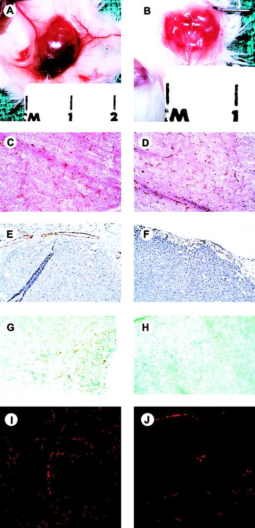 Fig. 4. Gross and microscopic appearance of NXS2-I-GFP and NXS2-TIMP-3-I-GFP-(high) tumors. / Gross appearance after reflection of the overlying skin and exposure of the subcutaneous tumors (A,B; marks are 1 cm apart). Immunohistochemical analysis of intratumoral vascularity as assessed by staining with anti–CD31 antibody (C,D; original magnification, × 25); intratumoral vessel SMA content (E,F; original magnification, × 25); intratumoral VE-cadherin expression (G,H; original magnification, × 25); and confocal microscopic analysis of functional vascular status demonstrated by the inherent autofluorescence of intravascular erythrocytes (I,J). NXS2-I-GFP tumors, left panels; NXS2-TIMP-3-GFP-(high) tumors, right panels.