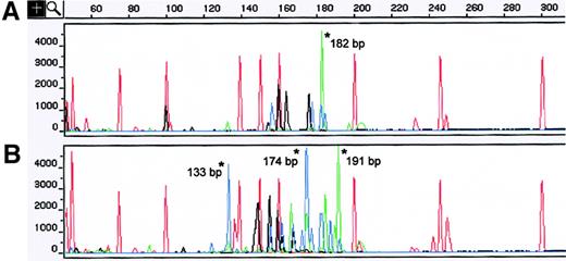 Fig. 2. TCR-γ analysis of concurrent MF skin biopsy specimens showing different clonal GRs. / (A) A skin sample obtained from the left foot displayed a dominant clonal TCR-γ GR of 182 bp that used the VγIV primer. (B) The left-hand lesion showed 3 different TCR-γ GRs of 191, 174, and 133 bp that used the VγIV and VγII families. Asterisks indicate TCR-γ GRs. The red peaks without asterisks correspond to internal size standards. Red indicates VγI; blue, VγII; black, VγIII; and green, VγIV.