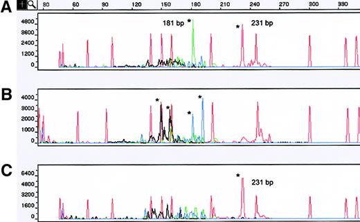 Fig. 3. TCR-γ analysis of both concurrent and sequential MF skin biopsy specimens. / (A) A sample obtained from left-thigh skin showed 2 dominant TCR-γ GRs of 231 and 181 bp that used the VγI and VγIV family primers. (B) A concurrent skin sample obtained from the right thigh showed an oligoclonal pattern with 4 dominant TCR-γ GRs that used VγII and VγIII family primers, respectively. (C) The third specimen, obtained 4 years later from the left thigh (same area as sample shown in A), displayed the same TCR-γ GR of 231 bp that used the VγI family primer. Sequencing confirmed that both GRs using VγI detected 4 years apart were the same. Asterisks indicate TCR-γ GRs. The red peaks without asterisks correspond to internal size standards. Red indicates VγI; blue, VγII; black, VγIII; and green, VγIV.