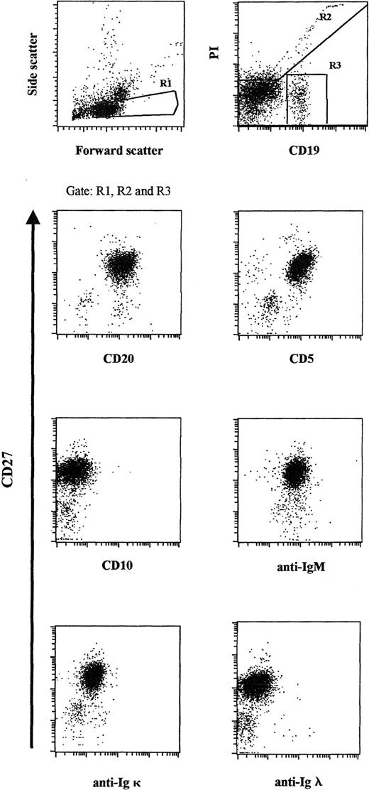 Fig. 1. Flow cytometric analysis of the expanded peripheral blood B-cell population. / Patient PBMCs were stained for CD19 and CD27 and gated according to light-scatter properties. Propidium iodide and CD19 expression were used to identify viable CD19+ cells. Cells were counterstained for CD20, CD5, CD10, sIgM, sIgκ light chain, and sIgλ light chain, respectively, and were plotted against CD27.
