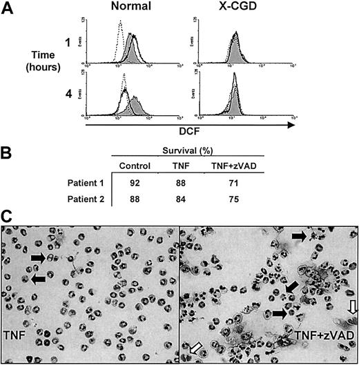 Fig. 8. The NADPH oxidase mediates intracellular oxidant production but not cell death in zVAD-sensitized, TNF-α–stimulated neutrophils. / Neutrophils isolated from healthy donors or 2 patients with X-linked chronic granulomatous disease (X-CGD) were preincubated with or without zVAD for 30 minutes. Subsequently, TNF-α was added at time 0. At 1 and 4 hours, intracellular production of reactive oxygen species was quantified by the accumulation of DCF fluorescence with flow cytometry (see “Materials and methods”). (A) Results from a healthy donor and patient 1 with documented X91+ subtype of X-CGD and complete absence of NADPH oxidase activity. Dotted contours indicate resting neutrophils; bolded contours, neutrophils stimulated with TNF alone; filled-in contours, neutrophils stimulated with TNF in the presence of zVAD. (B) Results of neutrophil survival in both patients by dual-parameter flow cytometry performed at 4 hours. Cytocentrifuge preparations of the neutrophils from patient 1 were stained with Diff-Quick at 6 hours (C; magnification, × 400). Note that the apoptoticlike (closed arrow) and the necroticlike (open arrow) cell death that occurred in patient 1 was similar to that described above.
