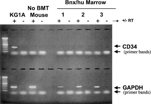 Fig. 3. RNA analysis. / RT-PCR analysis was done to analyze CD34 expression in the marrow of long-term engrafted primary bnx recipients of human CD34+/CD38− cells. The KG-1A cell line was used as a positive control, and nontransplanted bnx mouse marrow as a negative control. Marrow samples from 3 bnx mice that had no cell surface CD34 expression were tested. Eight months after engraftment, mouse 1 had 22.1% human CD45+ cells in its marrow. Twelve months after engraftment, mouse 2 had 13.4% human CD45+ cells in its marrow and mouse 3 had 35.6% human CD45+ cells in its marrow.