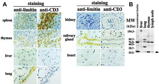 Fig. 5. Localization of the longer limitin protein in tissues of healthy mice. / (A) Sections of the indicated murine tissues were stained with anti-limitin or anti-CD3 and photographed; original magnification, × 400. (B) Whole cell lysates were isolated from the indicated tissues and subjected to Western blot analysis probed with antilimitin. The arrow indicates the limitin protein. Each photomicrograph and blot shows 1 of 3 independent experiments that gave similar results.