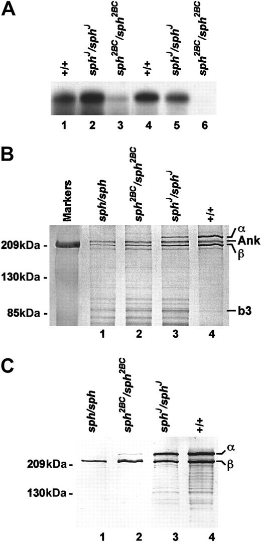 Fig. 3. Downstream effects of mutations. / (A) Northern blots of total RNA from spleen (lanes 1-3) and reticulocytes (lanes 4-6) of +/+ (lanes 1,4),sphJ/sphJ (lanes 2,5), andsph2BC/sph2BC (lanes 3,6) mice. UV shadowing was used to check RNA loading. (B) Laemmli SDS-PAGE of RBC ghost proteins from +/+ (lane 4) and mutant (lanes 1-3) mice. Genotype of mice is indicated above each lane. Size markers are indicated on the left; relative positions of α-spectrin (α) ankyrin (ANK), β-spectrin (β), and band 3 (b3) are indicated on the right. Ratios of α, ANK, and β to b3 are provided in Table 1. (C) Immunoblot of RBC ghost proteins from +/+ (lane 4) and mutant (lanes 1-3) mice. Genotype of mice is indicated above each lane. Primary antibody (1:250 dilution) detects α and β spectrin equally. Size markers are indicated on the left; relative positions of α and β spectrin are indicated on the right.