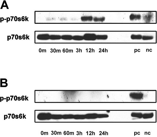 Fig. 3. p70S6k phosphorylation in B-CLL cells is inhibited by rapamycin. / (A) p70S6k expression and phosphorylation at threonin 389 (p-p70s6k) during 24 hours of activation with DSP30 and IL-2 were analyzed using specific antibodies. Cellular extracts of 293 cells cultured in the absence of or in the presence of serum were used as a positive (pc) and negative control (nc), respectively. (B) The same experiment was performed in the presence of 50 ng/mL rapamycin. Similar results were obtained in 2 additional experiments (data not shown).