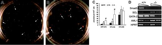Fig. 6. Identifications of HPP-CFC and primitive progenitor-related gene expression within day 6 wild-type and Smad5−/− EBs. / HPP-CFCs derived from day 6 EBs of wild-type (A) and Smad5−/− (B) ES cells were able to generate macroscopic colonies in vitro. Macroscopic colonies by HPP-CFCs are shown by white arrows; secondary EBs are shown by white arrowheads. Grid lines on the dishes are spaced 2 mm apart. Note the solid and round morphology of secondary EBs, whereas the HPP-CFCs displayed a looser morphology and often with red hemoglobin. The actual number of HPP-CFC, erythroid mix (CFU-mix), and CFU-GM colonies derived from day 6 EBs are shown in panel C. The results are shown as means ± SEM from 3 representative experiments; the other 2 experiments demonstrated similar results. Significance was determined using the Studentt test. *represents data found to be significantly different from wild-type control values (P < .05); #, data found to be significantly different from Smad5+/− values (P < .05). The patterns of gene expression were defined using day 6 EBs by RT-PCR (D). The arrows on the top of the photo in panel D represent the 10-fold dilution of samples.