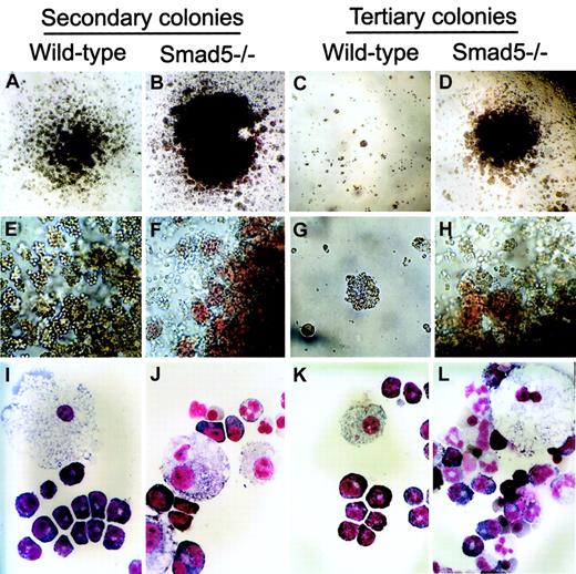 Fig. 8. Secondary and tertiary colonies derived from primary wild-type and Smad5−/− HPP-CFCs in replating assay. / Most of the Smad5−/− HPP-CFC colony was able to form secondary HPP-mix consisting of erythrocytes, granulocytes, mast cells, and macrophages (B,F,J), whereas wild type generated almost all HPP-GMs (A,E,I). In tertiary cultures, no macroscopic HPP-CFC colony was detected in wild-type culture (C,G,K), whereas the tertiary macroscopic HPP-CFC colonies, most of which were of mixed cellular content, were readily observed in mutant culture (D,H,L). Original magnifications: panels A-D, × 40; panels E-H, × 200; and panels I-L, × 1000.