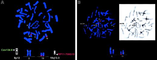 Fig. 2. Results of the 2-color FISH analysis. / Digoxigenin-labeled BAC clone RP11-706G10 (red signals) and biotinylated Cos 134.8 (green signals) specific to HERV-Kand FGFR1 genes, respectively, were used in the analysis. (A) Metaphase spread from normal lymphocytes showing FISH signals obtained with BAC clone RP11-706G10 (red) on chromosome 19q13.3 and with Cos 134.8 specific to FGFR1 (green) on chromosome 8p12, as expected. (B) Metaphase spread from the patient with the t(8;19) translocation. Chromosomes 8, 19, der 8, and der 19 with hybridizing signals are indicated. Note the red hybridization signals on both der 8 and der 19 chromosomes and their colocalization with FGFR1 signals, indicating that this BAC clone spans the breakpoint. Inset: R banding of the same metaphase. Original magnifications, ×100.
