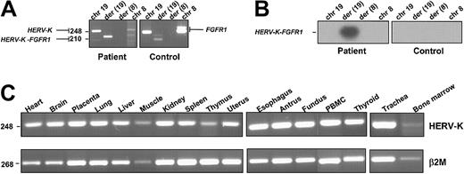 Fig. 3. Expression of HERV-K, FGFR1, and the fusion genes. / (A) RT-PCR assay was performed on RNA extracted from leukemic cells containing the t(8;19)(p12;q13.3) and from healthy donor cells (control). HERV-K-FGFR1–specific transcript was detected in the patient sample but not in the healthy control sample.FGFR1 (2 variant products) and HERV-K (1 product) were detected in both patient and control samples. Chromosomal positions are indicated at the top. PCR products are indicated on the right and left. Primer sequences are given in “Study design.” Primer pairs used were as follows: row 1 (chr19), HERV-K–sense and –antisense; row 2 (der(19)), HERV-K–sense and FGFR1-antisense; row 3 (der(8)), FGFR1-sense and HERV-K–antisense; row 4 (chr8), FGFR1-sense and -antisense (the latter primer pair detected 2 variants of the wild-type FGFR1). (B) The Southern blot of the PCR products shown in panel A was probed with the oligonucleotide spanning the breakpoint, which is described in “Study design.” (C) Expression of the HERV-K gene. RT-PCR products were obtained from a variety of tissues (tissue type is indicated above each blot). Each panel is a photograph of the ethidium bromide–stained agarose gel in which PCR products were electrophoresed. β2-Microglobulin amplification was used to estimate the efficiency of RT-PCR reactions. PCR product sizes (bp) are indicated on the left.