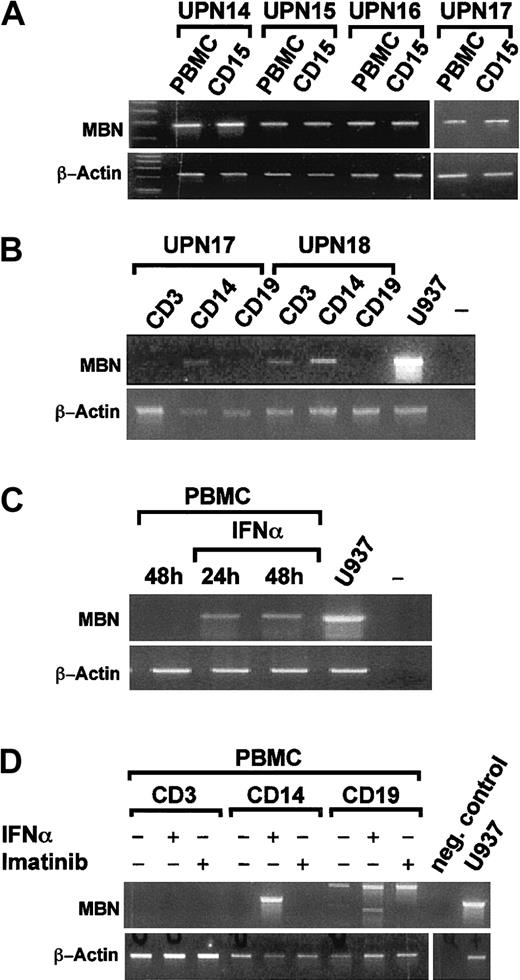 Fig. 3. MBN transcription in sorted cell populations of IFN-α–treated patients and after in vitro stimulation of PBMCs by RT-PCR. / (A) PBMC- and MACS-enriched CD15+ cell fractions of 4 patients (UPNs 14-17) in complete hematological remission under IFN-α therapy. (B) Sorted CD14+ monocytic, CD3+T-lymphocytic, and CD19+ B-lymphocytic cell populations, as indicated, of 2 patients (UPN 17 and UPN 18) in complete hematological remission. (C) PBMCs of a healthy donor were cultured 48 hours without and for 24 hours or 48 hours in the presence of 1500 U/mL IFN-α. Also shown are unstimulated U937 positive control (U937) and a no-template control (–). (D) CD3, CD14, and CD19 cell populations were sorted on a Moflo cell sorter. Then, 0.2 to 0.3 × 106cells of each population were seeded into media supplemented with 1500 U/mL IFN-α, 1 μM imatinib, or no supplements as indicated. At 24 hours after treatment, cells were harvested and MBN was expression assessed by RT-PCR. Panels B and C are each representative for experiments performed with material from 2 distinct donors/patients. For reference, β-actin gene transcription was assessed as depicted.