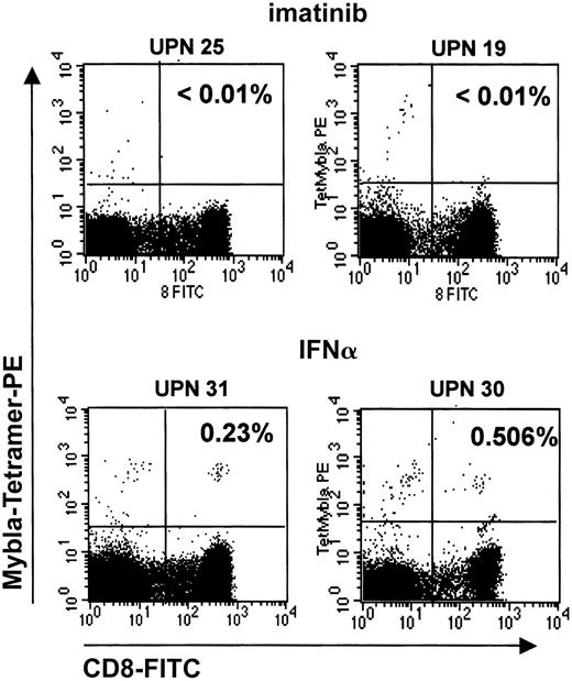 Fig. 5. PR1-CTLs in peripheral blood of imatinib-treated CML patients. / PR1-CTLs are rarely found in peripheral blood of imatinib-treated CML patients. PR1-CTLs were measured by means of iTAg MHC tetramers (Beckman Coulter). PE-conjugated iTAg MHC tetramers and FITC-labeled CD8-specific monoclonal antibodies (Becton Dickinson) were added to 100 μL whole blood, mixed, and incubated for 30 minutes at room temperature. Erythrocytes were lysed, and the remaining cells were measured on a FACScan (Becton Dickinson). Data were analyzed by means of CellQuest analysis software. Percentages of cells that stain for both CD8 and PR1 are given in the upper right quadrants. The 2 upper plots depict representative PR1-CTL− patients (UPNs 25 and 19) in complete remission under imatinib treatment; 2 lower plots depict 2 PR1-CTL+, IFN-α–treated patients (UPNs 31 and 30) in complete hematological remission.