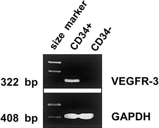 Fig. 2. RT-PCR for VEGFR-3 on human CD34+ and CD34− cells. / CD34+ and CD34− cells derived from human fetal liver were analyzed for the expression of VEGFR-3 and GAPDH mRNAs. One μg of total RNA from each sample was amplified by intron-spanning primer pairs. The results indicate that VEGFR-3 mRNA is expressed in CD34+ cells but not in CD34− cells.