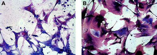 Fig. 6. Expression of lymphatic EC markers LYVE-1 and podoplanin on VEGFR-3+ cells in monolayers generated from isolated CD34+ cells. / Double immunostaining of EC monolayers derived from isolated fetal liver CD34+ cells detected adherent VEGFR-3+cells (blue; panels A and B) coexpressing lymphatic EC markers LYVE-1 (red; panel A) or podoplanin (red; panel B). Original magnification × 500.