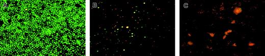 Fig. 3. Viability of cells migrated through endothelium. / Peripheral blood CD14+ cells were allowed to migrate across HUVEC monolayers. (A) Migrated cells. (B) Nonmigrated cells. (C) Cells migrated through the naked filter without endothelium. Cells were submitted to triple staining with HO, AO, and PI and analyzed in fluorescence microscopy. Notice in panel A the prevalence of green living cells on red and yellow apoptotic cells. Nonmigrated cells (B) appear mostly as apoptotic-necrotizing cells (yellow nuclei) or late apoptotic–necrotizing cells (red nuclei). Conversely, only orange-stained cellular debris are detectable when cells passed through the naked filter (C). One representative experiment of 4 is shown; original magnification × 200 for all panels.