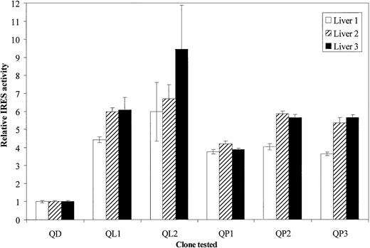 Fig. 3. Translation efficiencies of identified HCV 5′UTR quasispecies in hepatocytes in primary culture. / Hepatocytes from 3 different donors were used, respectively represented by ■, ▨, and ▪. Approximately 2 × 105 cells were seeded in 24-well plates coated with collagen. After a 3-day culture, they were infected with vTF7-3 recombinant vaccinia virus at 5 PFU/cell for 1 hour at 37°C and then transfected in triplicate as described in “Materials and methods” with respective bicistronic constructs, containing each of the identified HCV quasispecies. At 18 hours after transfection cells were lysed and assayed for luciferases activities. For each quasispecies (QD, QL1, QL2, QP1, QP2, and QP3) IRES relative activities were given as RLuc/FLuc ratios normalized to the QD (originated from DCs) RLuc/FLuc ratio. The data bars and error bars represent the means and SDs of 3 independent triplicate transfections.