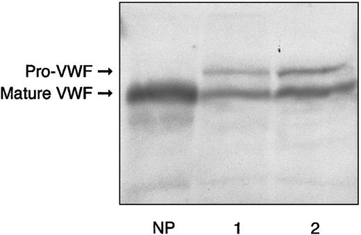 Fig. 2. Electrophoresis of plasma from proband and his father in 5% reducing SDS-PAGE, as compared with normal plasma. / Lane 1 sample is derived from the proband; lane 2, from the proband's father; NP indicates normal plasma. The bands were detected by125I–anti-VWF antibody.