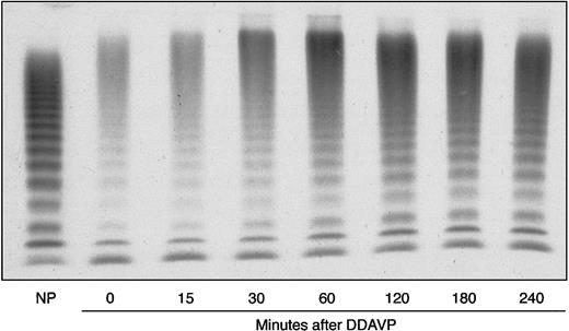 Fig. 4. Proband's DDAVP-induced modifications in plasma VWF multimer pattern, as compared with NP. / Electrophoresis was carried out in a 1.2% agarose gel under nonreducing conditions. The blood samples were collected before (0 minutes) and 15, 30, 60, 120, 180, and 240 minutes after administration of DDAVP.