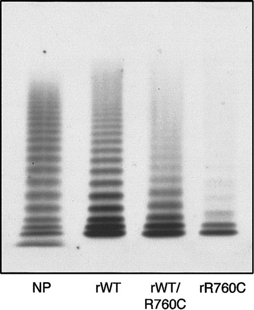 Fig. 7. Multimer pattern of rWTVWF, hybrid rWTVWF/R760C VWF, and homozygous rR760CVWF obtained by 1.2% agarose gel electrophoresis. / rWT indicates rWTVWF; rWT/R760C, hybrid rWTVWF/R760C VWF; rR760C, homozygous rR760CVWF; and NP, normal plasma.