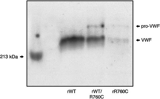 Fig. 8. SDS-PAGE of rWT, hybrid rWT/R760C, and homozygous rR760C. / Myosin, having a molecular weight of 213 kDa, was used as a marker.