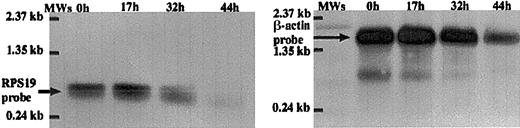 Fig. 3. RPS19 mRNA decreased during terminal erythroid differentiation. / We studied RPS19 gene expression by Northern blot analysis of FAV cells. As shown in the panel on the left, the expression of RPS19 mRNA decreased over the time course 0 to 44 hours of terminal erythroid differentiation. The expression of β-actin mRNA is shown in the panel on the right. Molecular weight standard (MWs) was loaded and the position of the markers is indicated.