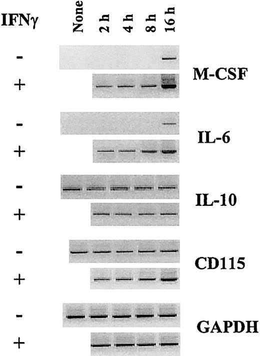 Fig. 3. IFN-γ enhances M-CSF and IL-6 mRNA expression by monocytes in GM-CSF plus IL-4. / Freshly isolated monocytes were not (none) or were cultured in GM-CSF plus IL-4 in the absence or presence of 25 ng/mL IFN-γ. After 2, 4, 8, and 16 hours, the expression of the mRNA encoding M-CSF, IL-6, IL-10, CD115, and GAPDH was analyzed by RT-PCR.