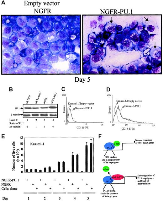 Fig. 7. Transient overexpression of PU.1 induces differentiation toward the monocytic lineage in AML1-ETO+ Kasumi-1 cells. / (A) PU.1 induces differentiation in t(8;21)+ Kasumi-1 cells. Kasumi-1 cells were transiently transfected with PU.1 (pGsam-PU.1-ires-NGFR) or the empty vector (pGsam-ires-NGFR) and morphologic changes were observed on day 5 (original magnification, × 63). Arrows indicate the differentiating cells. (B) PU.1 overexpression in Kasumi-1 cells. Western blot shows PU.1 expression and β-tubulin in transfected Kasumi-1 cells after day 5. (C) PU.1 induces CD11b expression in Kasumi-1 cells. FACS analysis was performed for the cell surface expression of CD11b in Kasumi-1 cells transfected with empty vector or PU.1. (D) PU.1 induces CD14 expression in Kasumi-1 cells. In the same experiment FACS analysis was performed for the cell surface expression of CD14 in Kasumi-1 cells transfected with empty vector or PU.1. (E) Kasumi-1 cell number decreases in PU.1-transfected cells. The transfected cells described in the legend to Panel D were counted by trypan blue staining on days 1, 2, 3, 4, and 5 after transfection. (F) Model of AML1-ETO blocking PU.1 function. Model is of AML1-ETO interacting with PU.1 and displacing its coactivator c-Jun. This down-regulation of the PU.1 transcriptional activity by AML1-ETO results in down-regulation of PU.1 target genes important for myeloid differentiation.