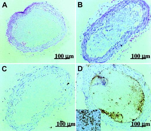 Fig. 3. Immunohistochemical evidence for the presence of intact 5H2 in the thrombus. / Hematoxylin-eosin staining of control thrombus induced by prolonged exposure (4 minutes) to xenon light (A) and thrombosis promoted by 10 mg/kg intravenous 5H2 (B). Immunohistochemical stainings of control thrombus (C) and of 5H2-promoted thrombus (D). Insert (original magnification × 16) shows association of 5H2 with individual platelets inside the thrombus.