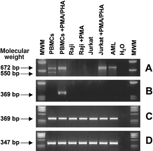 Fig. 4. RT-PCR analysis of CTLA-4 transcripts from normal and neoplastic, resting and activated, hematopoietic cells. / Total RNA from the indicated cells was reverse transcribed and PCR amplified with primers specific for CTLA-4 full-length coding sequence (A) and for CTLA-4 extracellular domain (B). Nested PCR was performed on the first-round CTLA-4 full-length PCR product as template with CTLA-4 extracellular domain inner primers (C). As internal control, β-actin gene amplification was carried out (D). PBMCs are freshly isolated peripheral blood mononuclear cells; Raji and Jurkat are B- and T-lymphoblastic cell lines, respectively; and AML is an adult acute myeloid leukemia sample. Molecular weights are expressed as base pairs (bp).