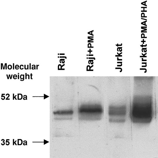 Fig. 5. Western blot analysis of CTLA-4 protein from resting and activated B-lymphoblastic (Raji) and T-lymphoblastic (Jurkat) cell lines. / Proteins from cell lysates were subjected to SDS–polyacrylamide gel electrophoresis (SDS-PAGE) on a nonreducing 12% (wt/vol) polyacrylamide gel, transferred to nitrocellulose membrane, and probed with scFv 83 mixed to the anti–c-myc tag 9E10 mAb. The reaction was visualized by ECL.