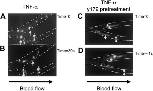 Fig. 4. Videotaped images of the inhibition of cytoadherence by PpMC-179 on TNF-α–stimulated human microvasculature in vivo. / Panel A shows rolling and adherent IRBCs as distinct bright circles in the postcapillary venules. Panel B shows the same vessel 30 seconds later, with the arrows indicating adherent IRBCs. Panels C and D, show the appearance of postcapillary venules when IRBCs were injected 10 to 15 minutes after 2 μm PpMC-179. The IRBCs were no longer adherent and were either rolling or became completely noninteracting (streaks).