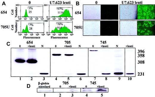 Fig. 6. Correction of aberrant splicing of HeLa EGFP and β-globin IVS2 mutants with U7 lentiviral vector. / (A) FACS analysis. EGFP-654 and EGFP-705U cells were transduced with U7.623 lentiviral vector and subjected to flow cytometry analysis after 2 weeks of transduction. (B) Fluorescence microscopy of identically treated cells. Phase contrast (left) and UV (right) images are shown. Magnification × 10. (C) RT-PCR of total RNA from HeLa β-globin IVS2-654 (lane 2), IVS2-705 (lane 5), and IVS2-745 (lane 8) cells transduced with U7.623 lentiviral vector. Untreated IVS2-654 (lane 1), IVS2-705 (lane 4), and IVS2-745 (lane 7) cells served as negative controls. Lanes 3, 6, and 9 show RNA from normal blood. Lane 10 shows IVS2-745 cells transduced with U7.623 lentiviral vector analyzed at 6 months. (D) Immunoblot analysis of total protein from HeLa IVS2-705 and IVS2-745 cells transduced as in panel C. The blots were probed with polyclonal anti–β-globin antibody. Lane 1, β-globin marker; lanes 2 and 4, untreated cells; lanes 3 and 5, lentiviral vector–transduced cells.