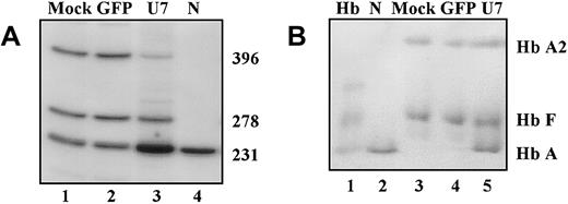 Fig. 7. U7.623 lentiviral vector–induced β-globin pre-mRNA repair in erythroid progenitors from patient with IVS2-745/IVS2-1 thalassemia. / (A)RT-PCR. On days 1 and 2 of culture, the cells were transduced for 5 hours with either no virus (lane 1), mock, GFP lentiviral vector (lane 2), or U7.623 lentiviral vector (lane 3). Lane 4 is RNA from normal blood. (B) Immunodetection of hemolysates separated by electrophoresis on cellulose acetate with antihuman hemoglobin antibody (“Materials and methods”). Lane 1, hemoglobin standards; lane 2, (N) normal blood; lane 3, mock-transduced cells; lane 4, cells transduced with GFP lentiviral vector; lane 5, cells transduced with U7.623 lentiviral vector.