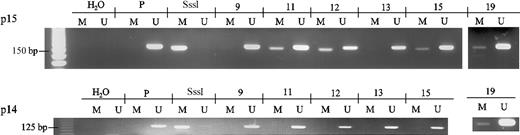 Fig. 1. Methylation status of. / p15INK4b andp14ARF analyzed by MSP. DNA was phenol/chloroform extracted from blood. Promoter methylation was determined by the method of MSP.4 The modified DNA was used as a template for PCR amplification using primers specific for either methylated or unmethylated DNA forp14ARF,7p15INK4b, andp16INK4a.4 The specificity of the PCR reaction was checked by sequencing the amplified fragments. Control without DNA was performed for each set of PCRs. Placental DNA treated or not in vitro with SssI methyltransferase (New England Biolabs, Beverly, MA) was used as positive control for the methylated or the unmethylated form, respectively. Examples are given for patients 9 to 19. M indicates methylated form; U, unmethylated form; P, unmethylated placental DNA; and SssI, methylated placental DNA. The DNA standards (methylated or unmethylated) gave the expected results.