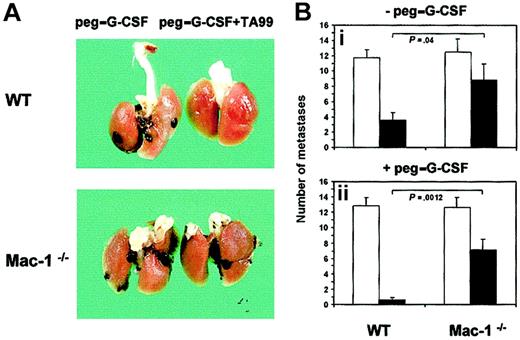 Fig. 3. Mac-1 requirement in Ab-mediated antimelanoma immunity. / The effect of mAb TA99 and peg–G-CSF on melanoma growth was studied in WT and Mac-1−/− mice. Upon tumor inoculation, mice were treated with saline or TA99 combined with or without peg–G-CSF. (A) Lungs were excised at day 21 to analyze surface metastases. (B) Numbers of metastases in saline-treated (■) or TA99-treated mice (▪) combined without (i) or with (ii) peg–G-CSF were quantified. Results represent means ± SEMs from 2 individual experiments (WT: n = 14; Mac-1−/−: n = 12). P values of significant differences were determined using unpaired Welcht tests.