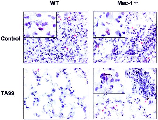 Fig. 4. Phagocyte infiltration into pulmonary metastases of WT and Mac-1−/− mice. / WT and Mac-1−/− mice were challenged intravenously with 1 × 105 B16F10 cells, and treated with peg–G-CSF and saline (control), or TA99 and peg–G-CSF as detailed in “Materials and methods.” Lungs were removed 15 days after tumor inoculation for immunohistochemistry. GR-1 staining (mouse neutrophil marker, shown in brown) of pulmonary tissue of WT (left panels) and Mac-1−/− (right panels) mice treated with (bottom panels) or without (top panels) TA99. Red arrows point at GR-1–positive cells. Original magnifications: × 400 (main panels) and × 1000 (insets).