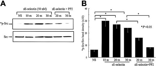 Fig. 3. sE-selectin–induced Src phosphorylation is inhibited by the Src inhibitor PP2. / HMVECs were stimulated with 50 nM sE-selectin for various time points as indicated (m indicates minutes; NS, nonstimulated). In the inhibition study, HMVECs were pretreated with PP2 (10 μM) for 2 hours prior to stimulating with sE-selectin, and PP2 was also present during the stimulation with sE-selectin. Cell extracts were prepared, and the protein content in each sample was quantitated. Samples (20 μg each) were resolved by 10% SDS-PAGE and probed with rabbit antihuman phospho-Src (*p-Src) antibody. To verify equal loading, the blots were stripped and reprobed with rabbit antihuman total Src antibody. (A) Representative blot from 3 independent experiments. (B) Ratio of p-Src to total Src band density ± SEM from 3 independent experiments. *Represents a significant difference (P < .05) between the respective groups. sE-selectin induced a marked increase in Src phosphorylation at 10, 20, and 30 minutes after stimulation. Pretreatment of HMVECs with PP2 significantly inhibited Src phosphorylation.