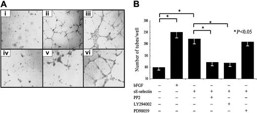 Fig. 7. sE-selectin induces endothelial cell tube formation on Matrigel in vitro. / The Matrigel in vitro HMVEC tube formation assay was performed in 8-well chamber slides. (A) Photomicrographs of representative assays for DMSO; bFGF; sE-selectin; sE-selectin + PP2; sE-selectin + LY294002; and sE-selectin + PD98059. Original magnification, × 20. (B) Quantitative data for endothelial cell tube formation are expressed as number of tubes/well ± SEM from 3 independent experiments. bFGF is used as positive control. *Represents a significant difference (P < .05) between the respective groups. sE-selectin induced significantly more endothelial tube formation than vehicle control, and this tube formation was inhibited upon treatment with PP2 and LY294002. However, HMVECs treated with PD98059 did not show significant inhibition of sE-selectin–induced endothelial cell tube formation.