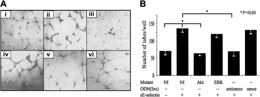Fig. 8. HMVECs transfected with Akt dominant-negative mutants or Src antisense ODNs show significantly less sE-selectin–induced tube formation. / HMVECs were transiently transfected with a pcDNA3 plasmid containing ERK1/2 and Akt dominant-negative mutants or with Src sense or antisense ODN. Plasmid with no insert was used as a negative control. HMVECs transfected with mutants were used for Matrigel in vitro HMVEC tube formation assays 72 hours after transfection, whereas HMVECs transfected with Src ODNs were used 16 hours after transfection. (A) Photomicrographs of a representative assay for (i) HMVECs transfected with no insert, (ii) HMVECs transfected with no insert and stimulated with sE-selectin, (iii) HMVECs transfected with an Akt mutant, (iv) HMVECs transfected with an ERK1/2 mutant, (v) HMVECs transfected with Src antisense ODNs and stimulated with sE-selectin, and (vi) HMVECs transfected with Src sense ODNs. Original magnification, × 20. (B) Quantitative data for HMVEC tube formation are expressed as number of tubes/well ± SEM from 4 independent experiments. *Represents a significant difference (P < .05) between groups. HMVECs transfected with Akt dominant-negative mutants and Src antisense ODNs showed significantly less tube formation compared with HMVECs transfected with no-insert plasmid.
