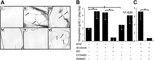 Fig. 9. PP2 and LY294002 inhibit sE-selectin–mediated blood vessel formation in Matrigel plugs in vivo. / (A) A representative assay showing Masson trichrome staining of blood vessels in paraffin sections of Matrigel plugs treated with PBS; bFGF; sE-selectin; sE-selectin + PP2; sE-selectin + LY294002; and sE-selectin + PD98059. Arrows indicate blood vessels. Original magnification, × 40. (B) sE-selectin induced significantly more blood vessel formation (*P < .05, n = 18) compared with the PBS group. The values represent the concentration of hemoglobin (g/dL)/Matrigel-plug weight (mg) ± SEM, with n indicating the number of plugs. The Src inhibitor (PP2) and PI3K inhibitor (LY294002) significantly inhibited sE-selectin–mediated blood vessel formation. However, the MAPK inhibitor (PD98059) failed to significantly inhibit sE-selectin–mediated blood vessel formation. (C) bFGF-induced blood vessel formation was significantly inhibited by the MAPK inhibitor PD98059.