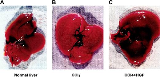 Fig. 1. Immunodeficient (NOD/SCID) mouse liver damaged by CCl4, with and without rescue by hepatocyte growth factor (HGF). / Human stem cell–engrafted mice were injected intraperitoneally with 0.4 mL/kg carbon tetrachloride (CCl4), and then treated with or without 4 intraperitoneal injections of 1.5 μg recombinant human HGF (rhHGF) at 12-hour intervals, 48-72 hours after CCl4 treatment. (A) Age-matched normal liver. (B) CCl4-treated liver. (C) Mouse liver treated with CCl4 and HGF.