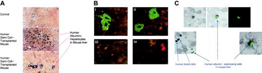 Fig. 4. Immunohistochemistry and in situ hybridization to detect human albumin expression in human cells. / (A-B) Human albumin expression in the livers of chimeric NOD/SCID/β2M-null mice that had received liver injury with or without rhHGF. (A) Slides were made from paraffinized liver sections prepared from the chimeric and control mice, and immunohistochemistry was performed using an antihuman albumin antibody that did not cross-react with the murine hepatocytes (A). The antibody was visualized with a blue chromogen. Panel A shows a low magnification image of a control slide prepared using the same reagents. Panels B-C show low and high magnifications of the albumin-expressing human cells that were detected distributed throughout certain regions of the chimeric liver from one of the mice that had received recombinant human HGF after CCl4-mediated liver injury. Specific areas of the chimeric livers appeared heavily repopulated, as shown, although other areas were nearly devoid of human albumin–expressing cells. Panel B: (i-ii) High magnification of human albumin–expressing cells identified with an antihuman albumin-FITC antibody in liver sections. Nonalbumin-expressing human or mouse cells are seen surrounding the albumin–expressing cells. The background level of autofluorescence in injured tissues can be seen in the control sections (iii-iv) taken from mice that had received both CCl4 and HGF but no human stem cell transplantation. (C) Human cord blood stem cell–derived albumin-expressing cells recovered from the livers of injured, chimeric NOD/SCID/β2M-null mice. To reduce the chance of artifacts appearing from overlaid cells, cytospin slides of dissociated hepatocytes were prepared. Slides were stained with antihuman albumin-FITC Ab, and then in situ hybridization was performed using a probe specific for human DNA Alu sequences. The upper panel shows a brightfield image (left) and the fluorescent image (right) with an overlay image in the center. Human hepatocyte–like cells appear green in the cytoplasm, detected by the antihuman albumin-FITC antibody, and black in the nuclei, as detected by DAB reaction for human Alu sequences. Human blood cells showed black nuclei only (Alu+) without cytoplasmic albumin expression. Original magnifications: × 10 (A); × 100 (B); and × 20 (C).