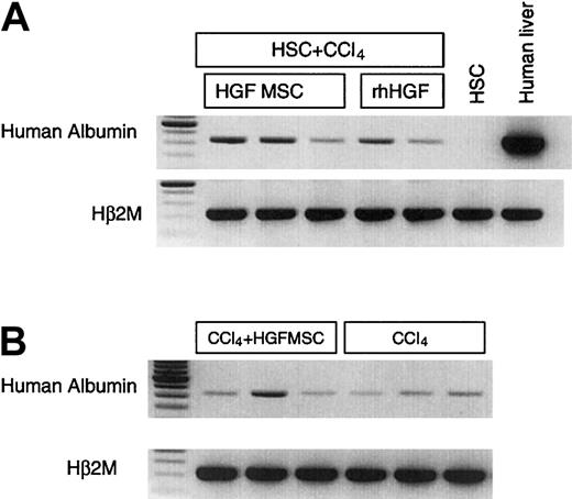 Fig. 5. Human albumin expression in mice that received transplants of HGF-secreting MSC. / (A) Systemic HGF production induced human albumin expression in CB HSC–transplanted NOD/SCID/β2M-null mouse liver. Normal human MSCs were transduced with a retroviral vector expressing HGF and transplanted into chimeric, CCl4-treated mice (n = 6). Human albumin expression appeared as early as 5 days after CCl4 and HGF injection. The comparison of human albumin expression in HGF MSCs and rhHGF-injected mouse liver is shown. (B) Human albumin expression in human bone marrow–derived stem cell transplanted mouse liver. Human marrow-derived CD34+ cells were transplanted into NOD/SCID/β2M-null mice. CCl4 with or without human HGF-secreting MSCs was administered into the engrafted mice (n = 6). Human albumin expression by RT-PCR in the mouse liver is shown. The first lane in both panels show molecular weights.