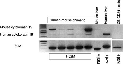 Fig. 6. Human cytokeratin 19 expression in the livers of injured mice that underwent human stem cell transplantation and were treated with HGF. / When NOD/SCID/β2M-null mice received transplants of human stem cells (CB- or BM-derived CD34+ cells) and were treated with CCl4 and HGF MSCs, cells expressing mRNA for the human cholangiocyte marker cytokeratin 19 (CK19) were found in the mouse liver. In the injured, HGF-treated chimeric mice, 2 bands were observed. The first was murine CK19, which comigrated with the band from the control mice that did not undergo transplantation. The second band was a human-specific band of the expected size, which comigrated with the CK19 band from a human liver control. No human CK19 was detected in the murine control liver, or in freshly isolated CD34+ hematopoietic progenitors. The first lane shows molecular weights.