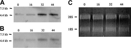 Fig. 4. Expression of alternative 5′ exons in erythroid progenitor cells. / Shown are Northern blot analyses of total RNA from Friend virus anemia–induced erythroblasts following culture for the times indicated (in hours). (A) Full-length cDNA probe. (B) Exon 1A probe. Both probes detected a single 4.1R mRNA band that increased during the course of differentiation. No hybridization was detected with probes for exons 1B and 1C under identical conditions (not shown). (C) Ethidium-bromide staining of ribosomal RNA. Equal (0, 16, and 30 h) or slightly reduced (44 h) loads of RNA were applied for each time point, supporting the idea that a true increase in 4.1R RNA expression has occurred in these cells.