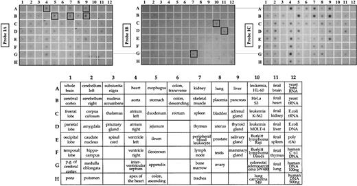 Fig. 5. Tissue-specific expression of alternative 5′ exons. / A master RNA blot (Clontech) containing poly A+ RNA from many human tissues and cell lines was blotted with probes for alternative exon 1A, exon 1B, or exon 1C. The 1A and 1C transcripts were particularly abundant in tissues with a high content of muscle cells (heart, A4; skeletal muscle, B7; and stomach, B5) as well as in pancreas (B9) and liver (A9). In contrast, exon 1B transcripts were most abundant in tissues enriched for early erythroid progenitors (fetal liver, D11; bone marrow, G7) and the erythroleukemia cell line K562 (C10). Lower panel shows the tissue map for all RNA sources tested.